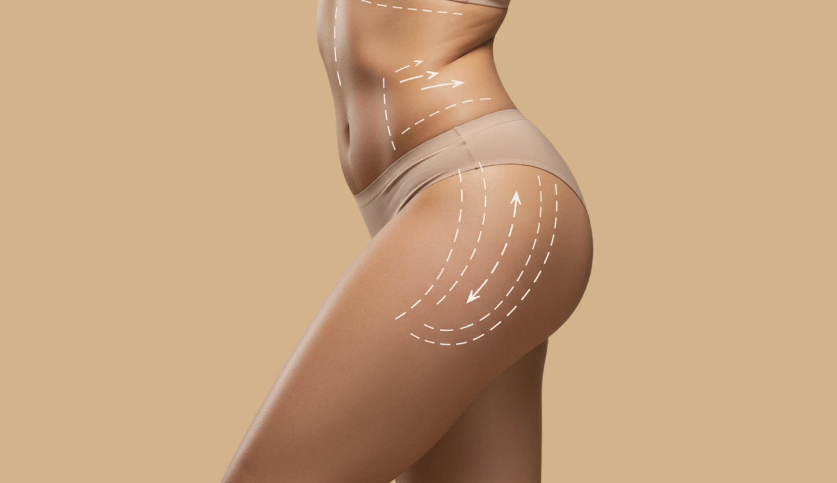 Tratamento injetável para redução de gordura localizada no culote e melhora do contorno corporal em João Pessoa, clínica Dra. Ana Paula Pontes.